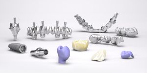 Implantat Suprastrukturen, Zahnersatz, Zahnimplantate,